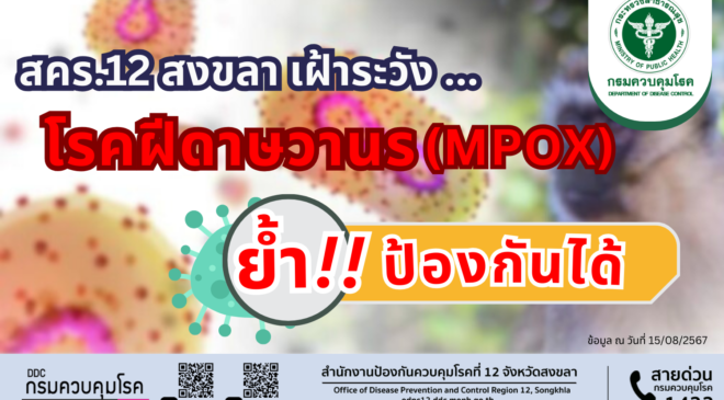 สคร.12 สงขลา เฝ้าระวังโรคฝีดาษวานร (Mpox) ย้ำ ป้องกันได้