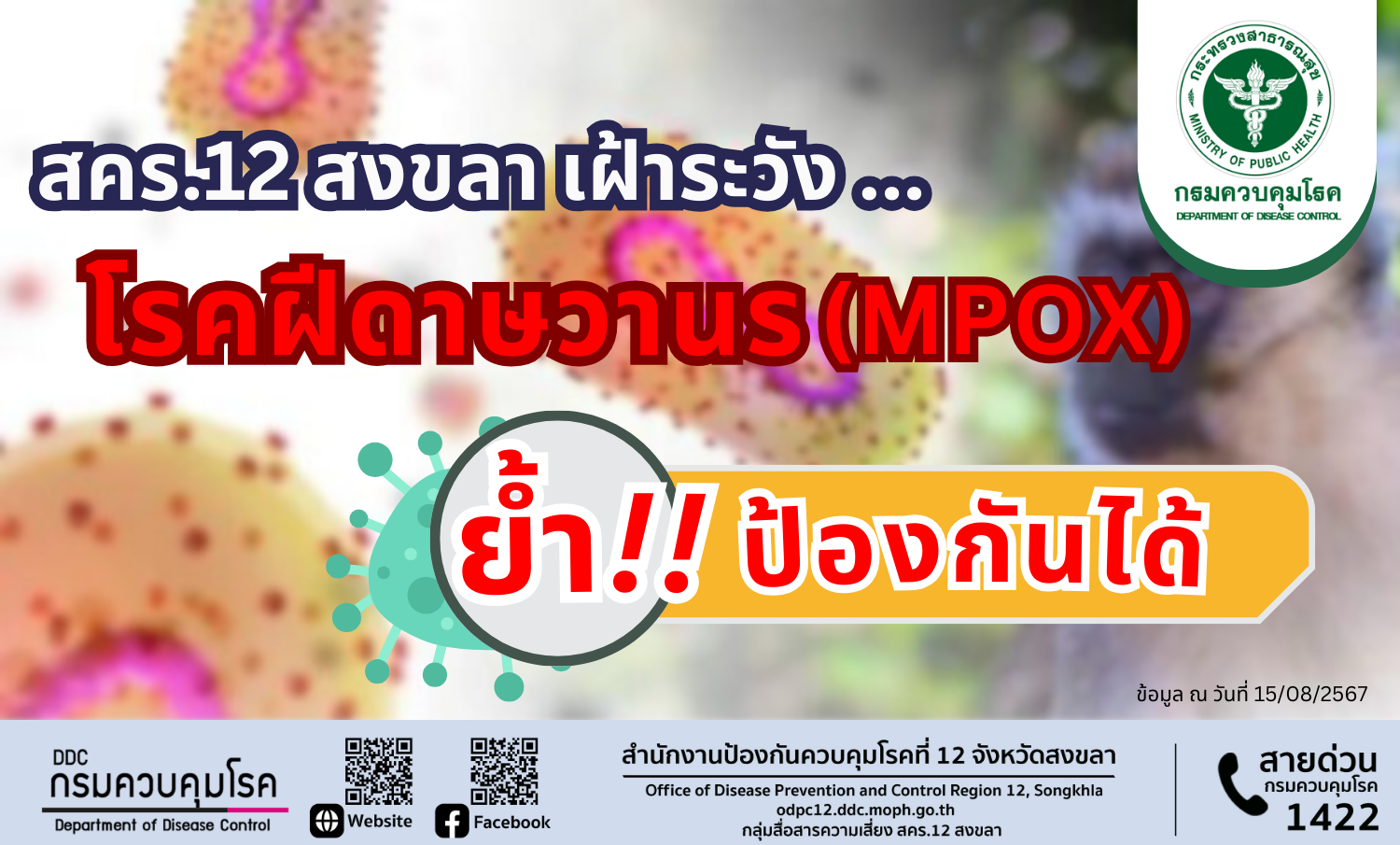 สคร.12 สงขลา เฝ้าระวังโรคฝีดาษวานร (Mpox) ย้ำ ป้องกันได้